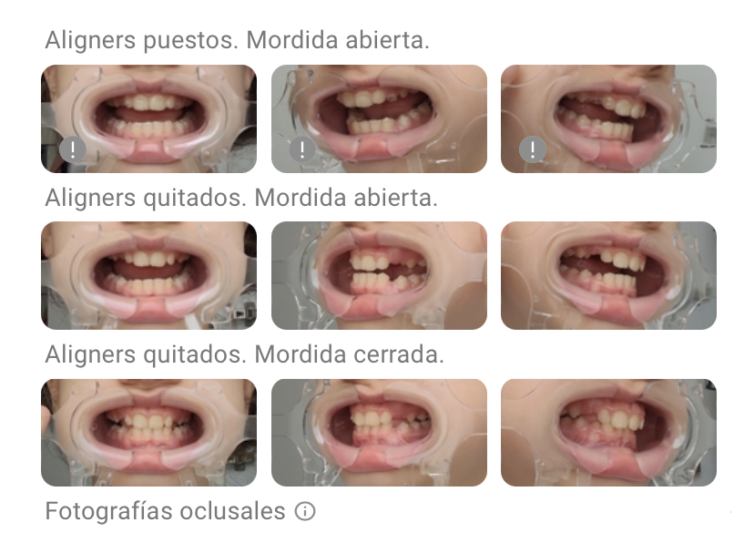 Dental Monitoring seguimiento niños
