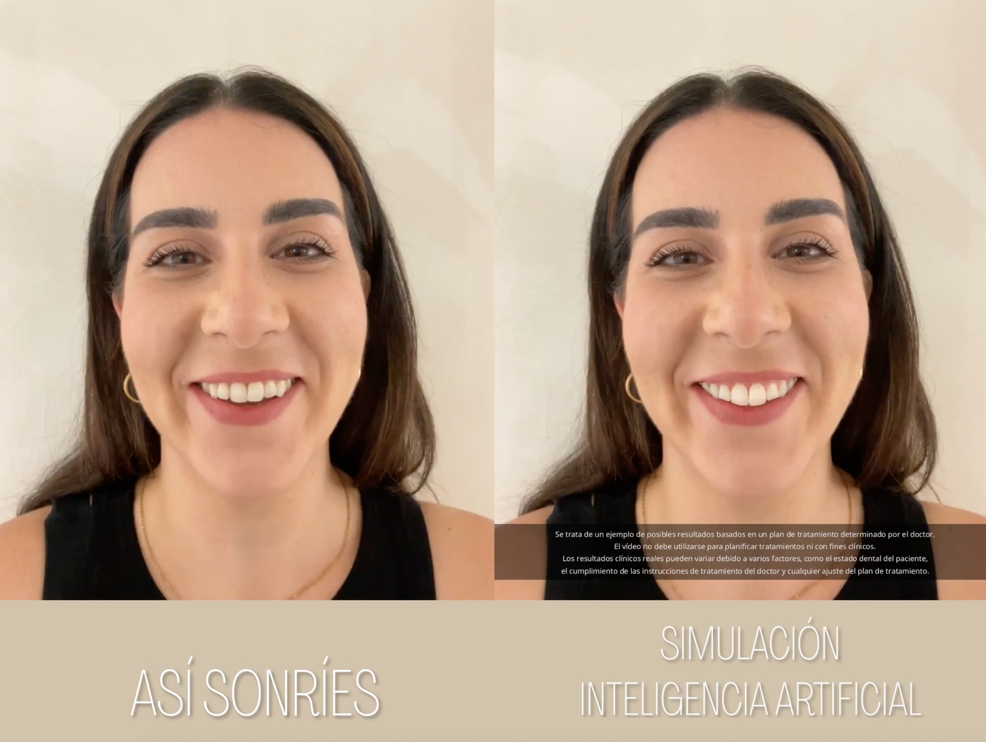 Simulación del resultado con inteligencia artificial: antes y después