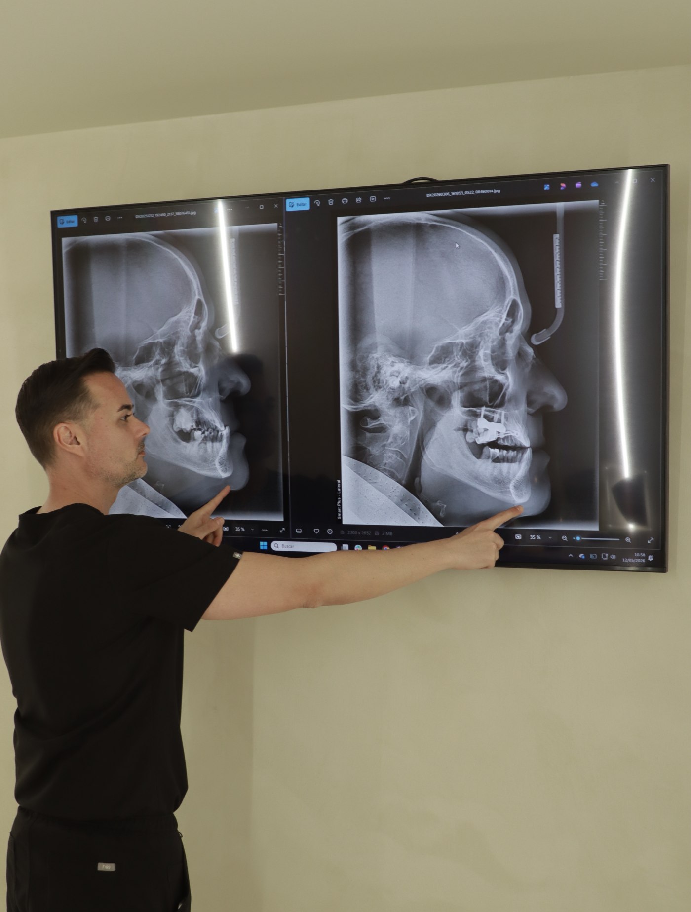 El Dr. Enrique Lozano explicando un diagnóstico con radiografías