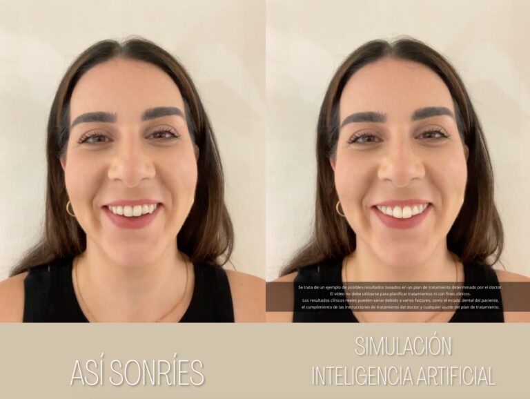 Simulación de sonrisa con inteligencia artificial: así sonríes y resultado simulado